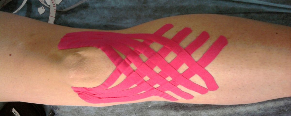 Torcedura de una articulación