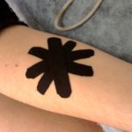 Inflamación o dolor articular